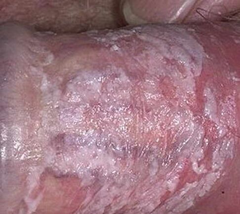 tiết dịch đông lại khi bị kích thích